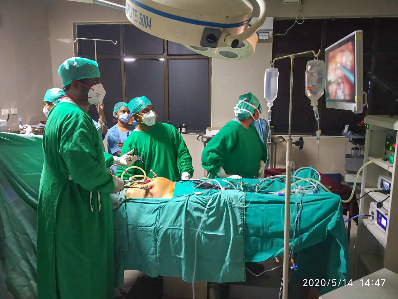 Laparoscopic theatre