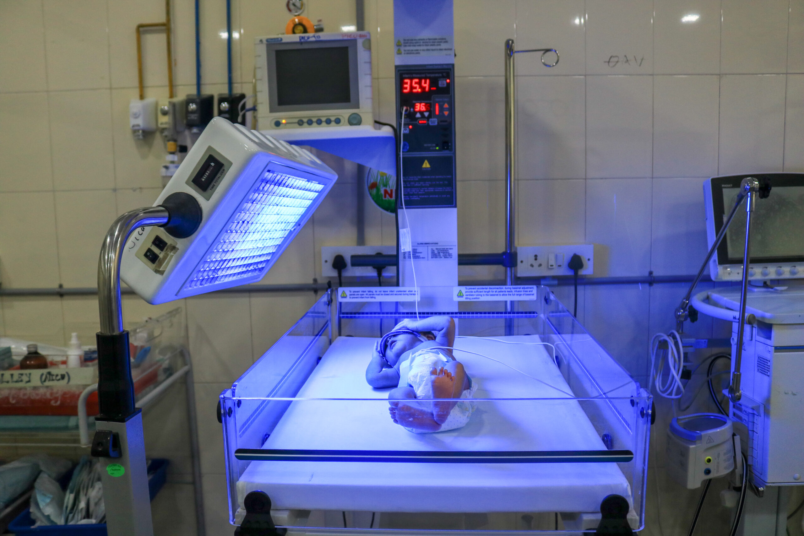 NICU phototherapy